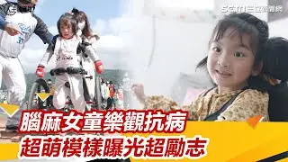 罕病萌妹／做什麼都吃力！腦麻女童樂觀抗病　超萌模樣曝光超勵志│94看新聞