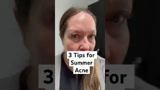 Tips to Prevent Summer Acne from an Aesthetic Nurse #skincare #acnetreatment #summerskincare
