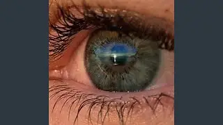 Timelapse