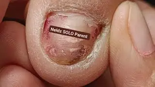 Co-worker Getting A Pedicure 😀 #satisfying Neldz SOLO Parent  is live!