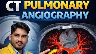 CT Pulmonary Angiography 128 Slice CT