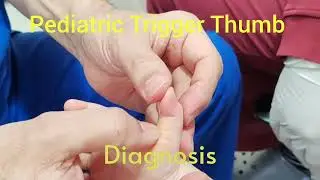 Diagnosis of Pediatric Trigger Thumb