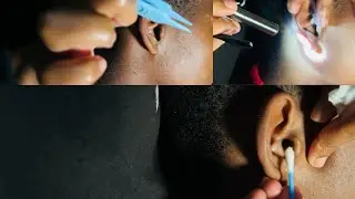 ASMR REAL PERSON EAR CLEANING & PLAYING