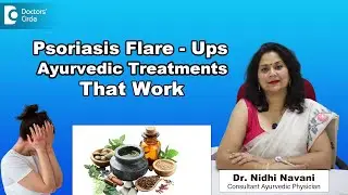 Psoriasis Treatment in Ayurveda | Control It Naturally - Dr. Nidhi Navani | Doctors' Circle