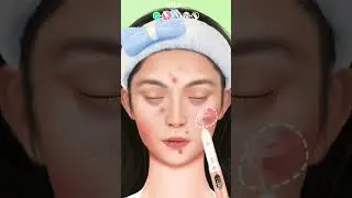 Makeover Studio: Makeup Games | Skin Laser Treatment 🤩| Available on Android & iPhone #Shorts