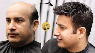 HAIR PATCHES FOR MEN: Spiky Hair in 2 Minutes | Hair Loss Solution 2024