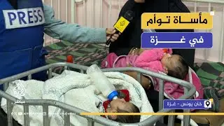 وزنهما قل بعد الولادة.. معاناة رضيعين توأم في غزة من نقص التغذية