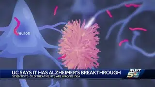 New Alzheimer's study at UC could be breakthrough in treating the disease