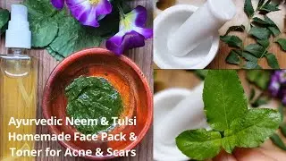 Get rid of Acne at home Naturally | Homemade Neem & Tulsi Face Pack & Toner | Acne Home Remedies