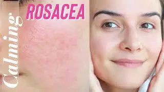 How I treat my Irritated/Rosacea Skin | Goodal Calming Toner Pads |Skincare Routine | Belorraine
