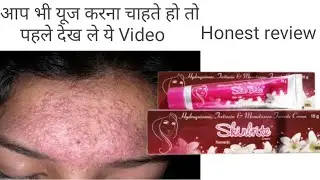 Skin brite Cream review || Skin whitening cream || skin brightening cream