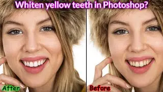 Photoshop - How to restore teeth to gleaming​ white