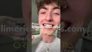 Sean gets fitted for Invisalign with Ennis & Limerick Braces