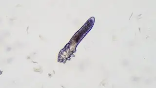 Face Mites Under The Microscope 🔬