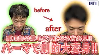 【薄毛】頭頂部の薄毛が気になる方必見！パーマで劇的大変身！！