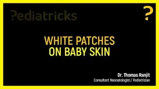 White patches on baby skin