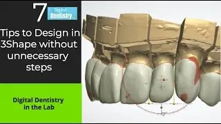 3Shape Anatomic Design: 7 tips you must try