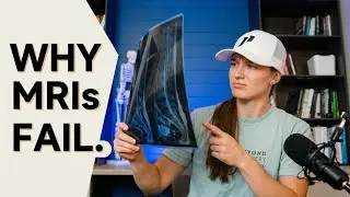 Should Lifters Get MRI's for Shoulder Pain? (Here's the RAW truth)