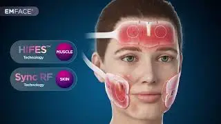 How EMFACE Works!