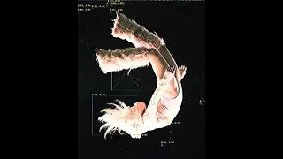 *free for profit* Hyperpop Jane Remover x 2hollis type beat - *last night*