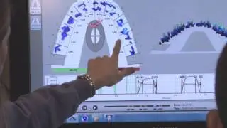 T-Scan Advanced Bite Analysis