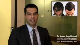 Best Hair Transplant Clinic in Los Angeles &ndash; Alvi Armani Beverly Hills