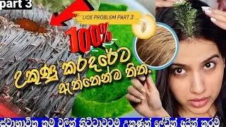 ✅🪳උකුණො ගෙදරදීම 100% ඉවත් කරන්න | Natural Lice Removal Tips