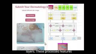 SkinGuard AI: Multimodal Mobile System for Dermatological Condition Detection and Report Generation