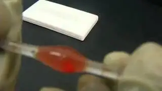 Haematology - The Red Blood Cell Count