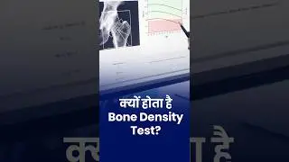 Bone Density Explained | Why Doctors Recommend Early Bone Density Test | Dr. Deepak Arora #short