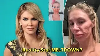 Brandi Glanville Suffers Chemical Burns After Using Nair to remove parasite on face