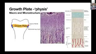 WEBINAR 1 - DEFORMITY CORRECTION BY GUIDED GROWTH