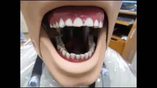 Posterior Periapical Radiographs Using Paralleling Technique