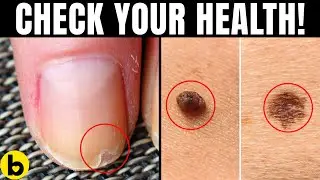 15 DIY Health Check Tricks That You Can Do At Home