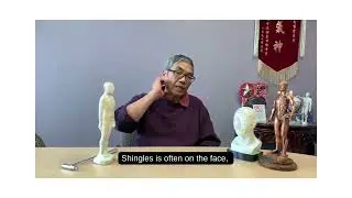 Shingle: Tong Ren Healing w/ Tom Tam 帶狀皰疹:  銅人療法譚輝