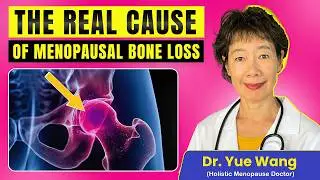 The One Truth About Osteoporosis 99% of Women Don’t Know
