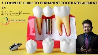 Dental Implants Explained | Best Fixed Tooth Replacement in Navi Mumbai