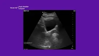 Vscan Air&trade; Product Tutorial | Auto Bladder Volume