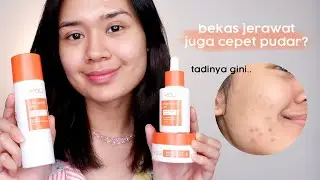CERAH DALAM 14 HARI? 🤔 - Y.O.U Radiance Up! Series Review