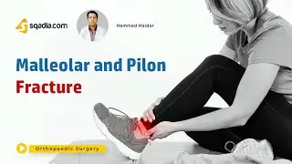 Malleolar and Pilon Fracture | Clinical Orthopaedic Surgery | V-Learning