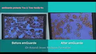 EMR effects on red blood cells forming rouleaux (clumping) under exposure