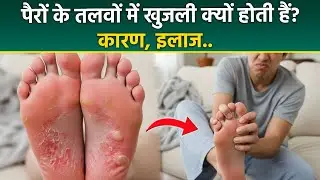 Causes Of Foot Itching : पैरों के तलवों में खुजली क्यों होती है | Feet Itching Home Remedy | Boldsky