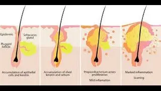 The sebaceous gland