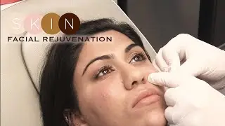 SKIN Prince George | Facial Rejuvenation | Vancouver Video Production | Citrus Pie Media Group