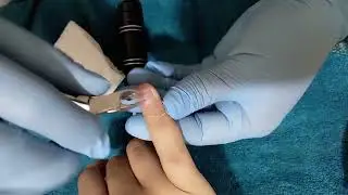 Limpieza y preparaci&oacute;n para colocaci&oacute;n de acrilico💅