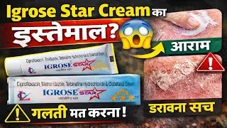 Igrose Star Cream का डरावना सच | गलत इस्तेमाल से स्किन खराब होती है?
