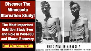 Discover the Minnesota Starvation Study! The Most Important Nutrition Trial Ever & Role in ICU-Rehab