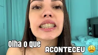 MINHA EXPERIÊNCIA COM APARELHO ESTÉTICO