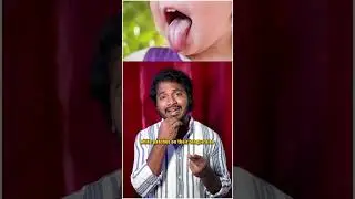 Why autistic child laugh excessively?👀 Hidden Reasons Parents Must Know!🔍