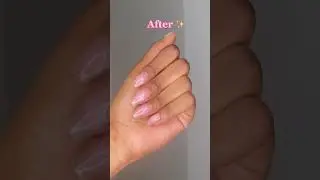 Our Natural Nails Serum will save your nails
